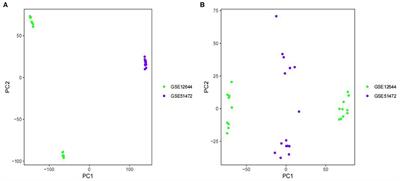 Bioinformatics and Machine Learning Methods to Identify FN1 as a Novel Biomarker of Aortic Valve Calcification